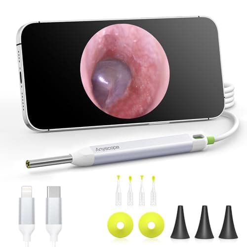 AnyScope HD Digital Otoscope, Video Ear Scope Otoscope with Light, Ultra Clear View Ear Camera with Ear Wax Removal Tools, Compatible with iPhone and Android Devices (White) ﻿